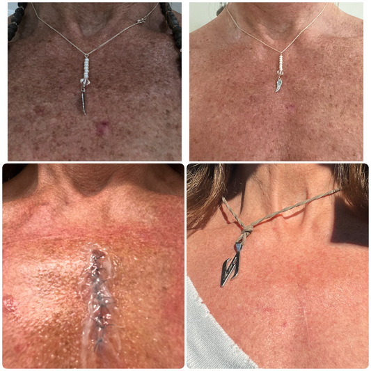 Skin Lover™ Emollient For Sensitive | Sensitive Skin Relief & High-Frequency Healing