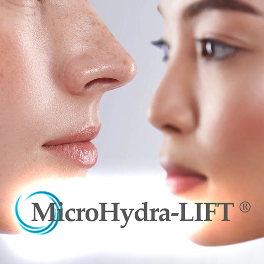 MicroHydra-LIFT Device